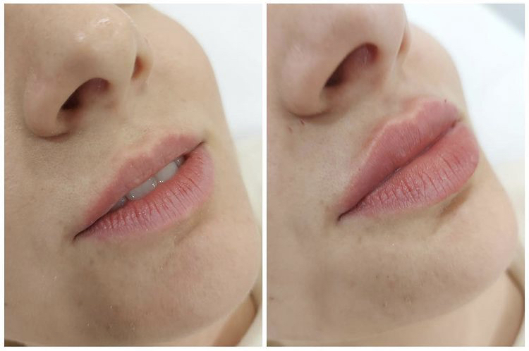 Look Beautiful, ljepota, estetska kirurgija, estetska dermatologija, zdravlje